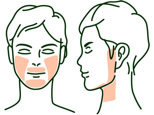 ヒゲ脱毛（メンズルシアクリニック）