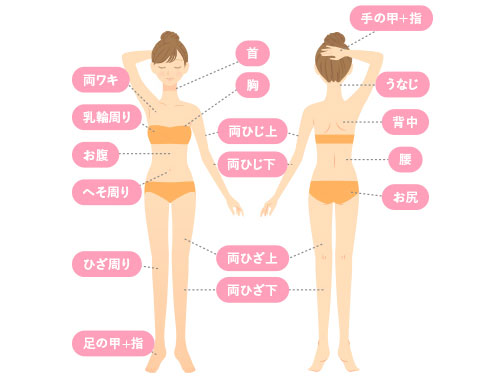 全身脱毛（アイリービューティークリニック）